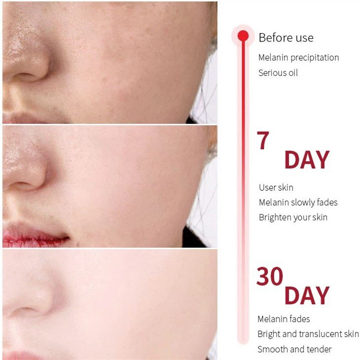 arbutin whitening serum