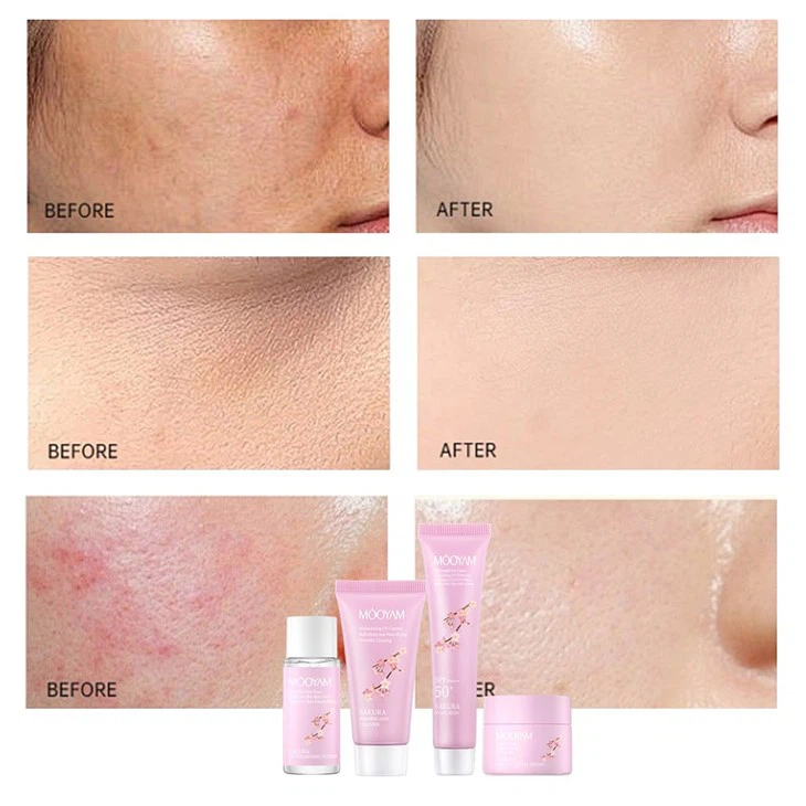MOOYAM SAKURA BRIGHTENING SKIN TRAVEL KIT